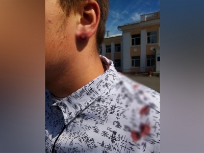 Директор школы под Курском порвал ухо ученику за отказ снять серьгу