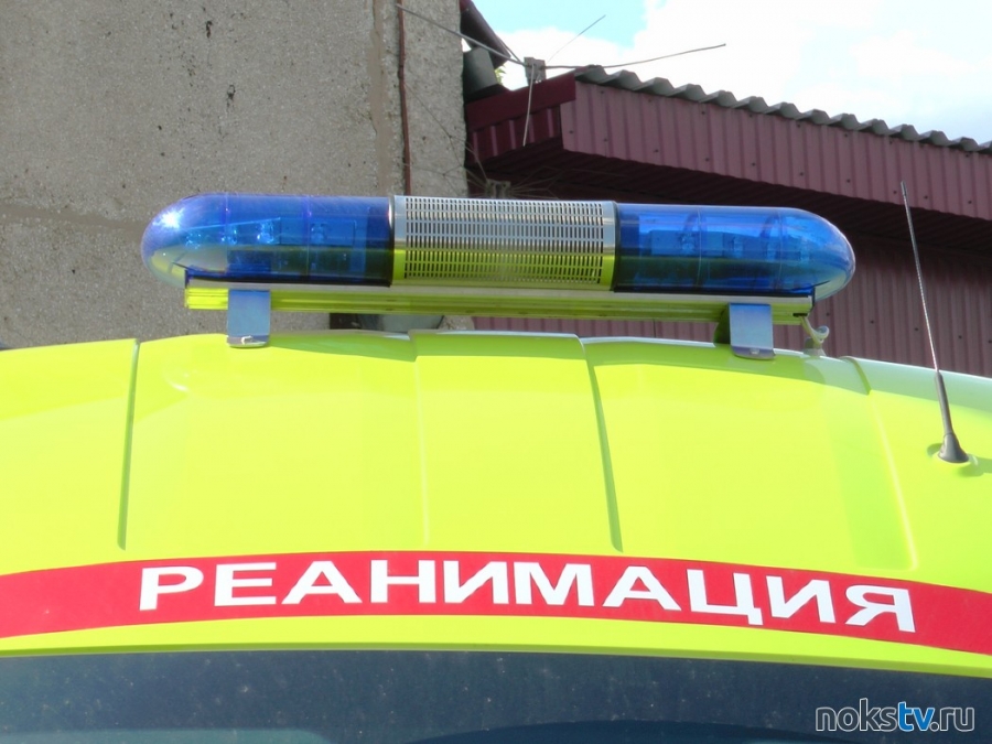 В Новотроицке мужчина получил ожоги лица и рук во время ремонта автомобиля