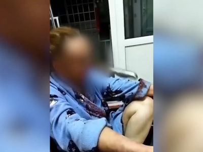 Пьяный муж в ходе ссоры попытался убить супругу ножом, но тот застрял у женщины в носу (Видео)